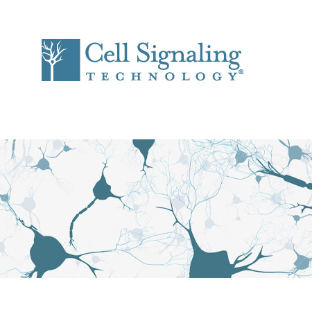 Cst.7074s	Anti-rabbit IgG, HRP-linked Antibody   1 ml