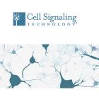 CST.13820s	Phospho-Smad1 (Ser463/465)/ Smad5 (Ser463/465)/ Smad9 (Ser465/467) (D5B10) Rabbit mAb #13820	100ul