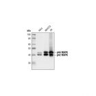 cst.4695T	p44/42 MAPK (Erk1/2) (137F5) Rabbit mAb #4695	20ul