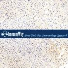 ImmunoWay.YP0176	mTOR Polyclonal Antibody	50uL