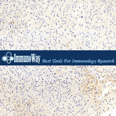 immunoway.MC0937-10mg	KC7F2	10mg