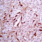 Merck-Millipore	AB152	Anti-Tyrosine Hydroxylase Antibody	100 µL