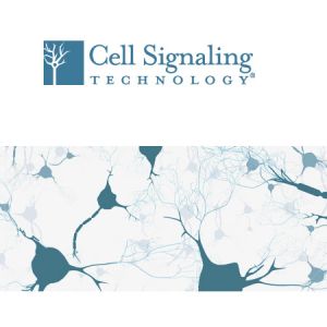 CST.9782T  	Epithelial-Mesenchymal Transition (EMT) Antibody Sampler  1 Kit 