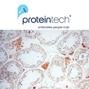 Proteintech	10881-1-1-ap	PTGES2抗体   50ul